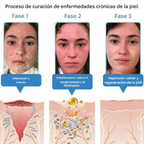 Crema antiinflamatoria multisíntomas con veneno de abeja (OFERTA 2X1)®