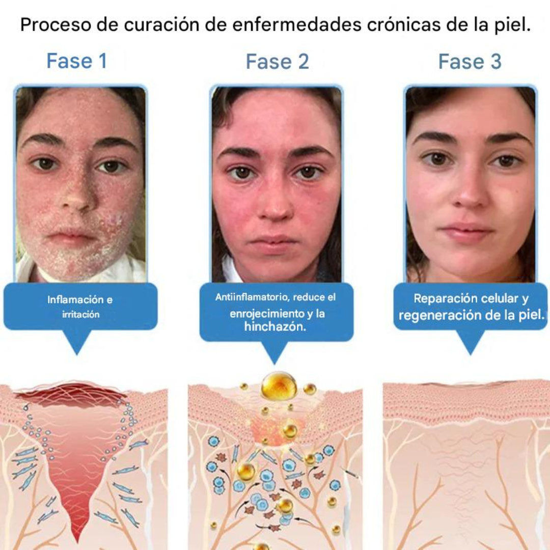 Crema antiinflamatoria multisíntomas con veneno de abeja (OFERTA 2X1)®
