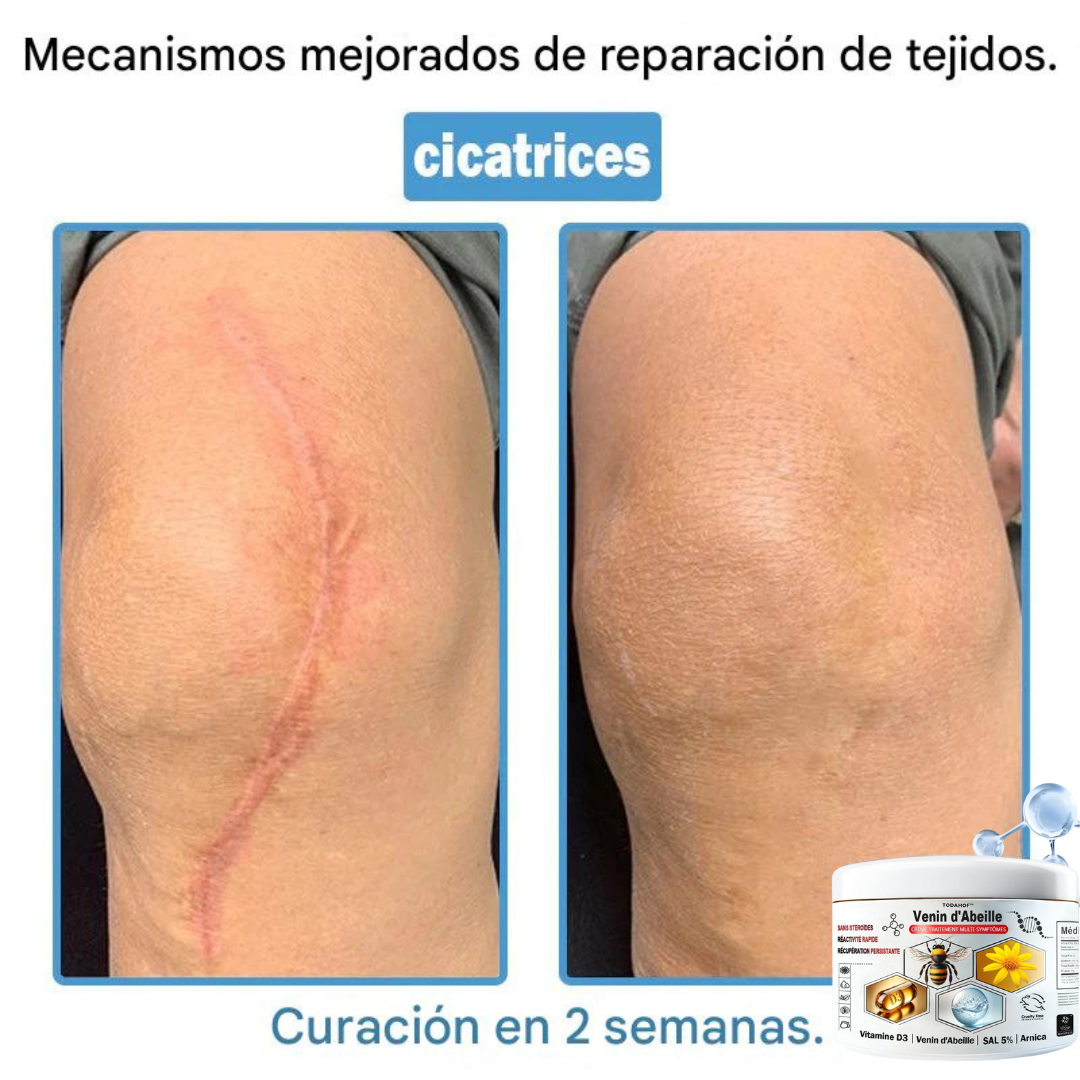 Crema antiinflamatoria multisíntomas con veneno de abeja (OFERTA 2X1)®